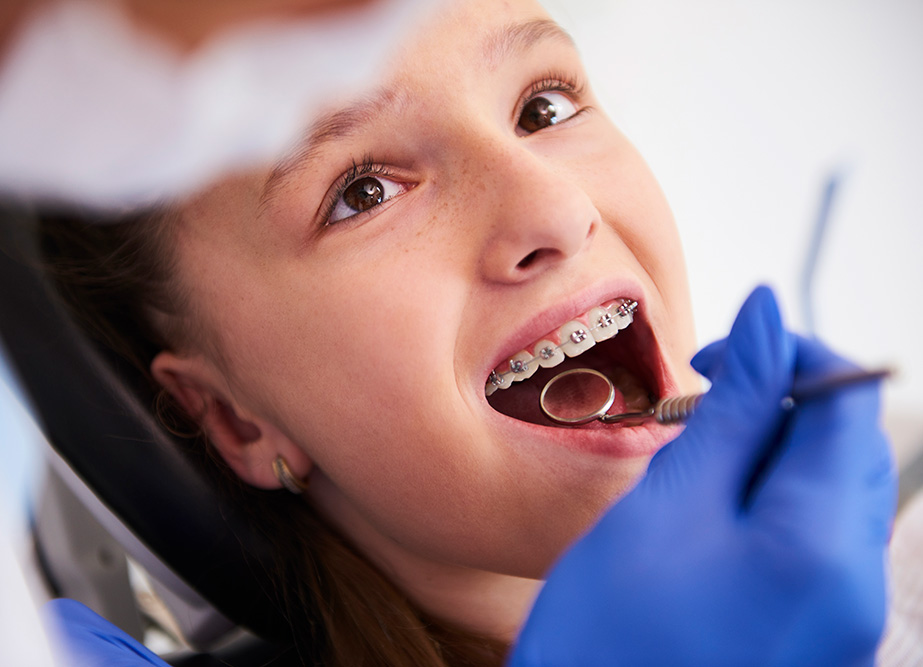 Ortodontia: Aparelho Fixo, Móvel e Alinhador | Dentista em Sorocaba | Consultório de Odontologia